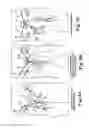 Fig. 07 - Surgical articles and methods