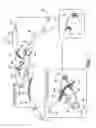 Fig. 08 - Surgical articles and methods