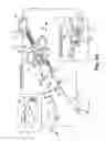 Fig. 10 - Surgical articles and methods