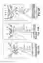 Fig. 15 - Surgical articles and methods