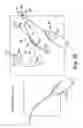 Fig. 19 - Surgical articles and methods