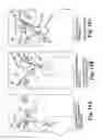 Fig. 20 - Surgical articles and methods