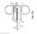 Fig. 25 - Surgical articles and methods