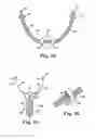 Fig. 31 - Surgical articles and methods