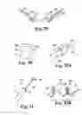 Fig. 33 - Surgical articles and methods