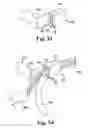 Fig. 34 - Surgical articles and methods
