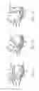 Fig. 09 - Pelvic implant with suspending system