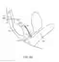 Fig. 10 - Pelvic implant with suspending system