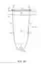 Fig. 12 - Pelvic implant with suspending system