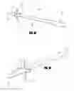 Fig. 02 - Devices and systems for lung treatment