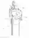 Fig. 01 - Needle capture device