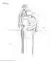 Fig. 07 - Needle capture device