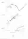 Fig. 08 - Needle capture device