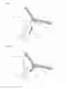 Fig. 19 - Needle capture device