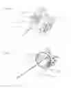 Fig. 31 - Needle capture device