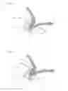 Fig. 43 - Needle capture device