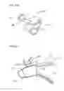 Fig. 57 - Needle capture device