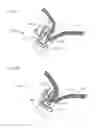 Fig. 63 - Needle capture device
