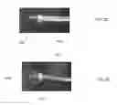 Fig. 05 - ENDOSCOPIC CANNULA AND METHODS OF USING THE SAME