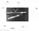 Fig. 09 - ENDOSCOPIC CANNULA AND METHODS OF USING THE SAME