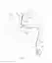 Fig. 02 - ROTATE-TO-ADVANCE CATHETERIZATION SYSTEM