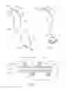 Fig. 04 - ROTATE-TO-ADVANCE CATHETERIZATION SYSTEM