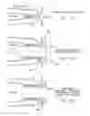 Fig. 24 - ROTATE-TO-ADVANCE CATHETERIZATION SYSTEM