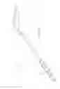 Fig. 55 - ROTATE-TO-ADVANCE CATHETERIZATION SYSTEM
