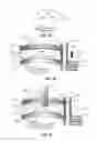 Fig. 04 - Devices for performing blepharoplasty and methods of using the same