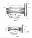 Fig. 07 - Devices for performing blepharoplasty and methods of using the same