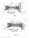 Fig. 08 - Devices for performing blepharoplasty and methods of using the same
