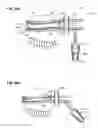 Fig. 15 - Devices for performing blepharoplasty and methods of using the same