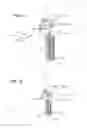 Fig. 17 - Method of using a surgical tissue retractor