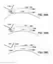 Fig. 34 - Apparatus for providing derived glucose information utilizing non-invasive physiological sensors