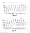 Fig. 07 - Measurement of patient physiological parameters