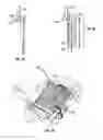Fig. 45 - Tissue penetration device