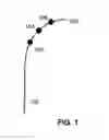 Fig. 02 - Image Registration Using Interventional Devices