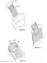 Fig. 06 - Instruments, Methods and Systems for Harvesting and Implanting Cartilage Material