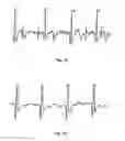 Fig. 02 - Apparatus and method for detecting a fetal heart rate