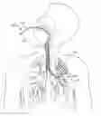 Fig. 01 - Methods and systems for endobronchial diagnosis