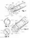 Fig. 02 - Snarecoil retrieval device for capturing and retrieving a specimen