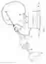 Fig. 03 - In-line fat tissue sampling, processing and collection device