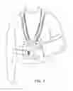 Fig. 02 - Arm sling with backpack straps
