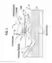 Fig. 03 - Ultrasound access disconnection systems and methods