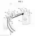 Fig. 04 - Ultrasound access disconnection systems and methods