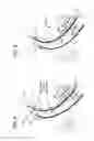 Fig. 08 - Ultrasound access disconnection systems and methods