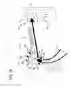 Fig. 12 - Ultrasound access disconnection systems and methods