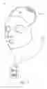 Fig. 07 - IONTOPHORETIC TRANSDERMAL DEVICE