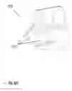 Fig. 11 - Multimodal surgical gas delivery system for laparoscopic surgical procedures