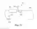 Fig. 17 - Apparatus and methods of treatment of pathologic proliferative conditions uterine tissue